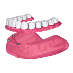 Dental Implants & Restorative Dentistry